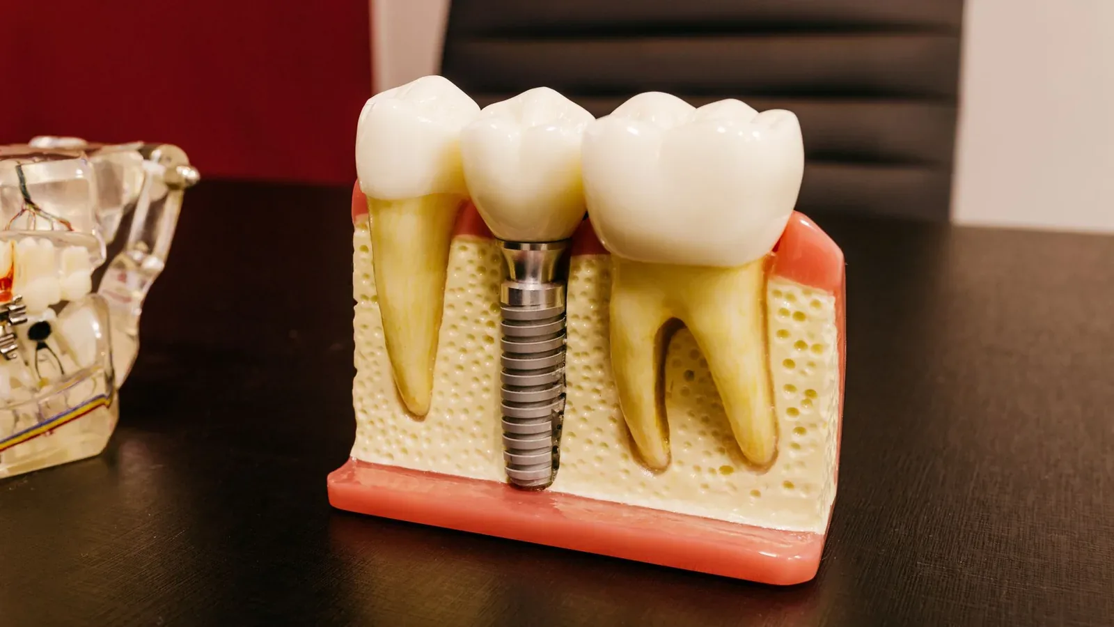 Implant treatment